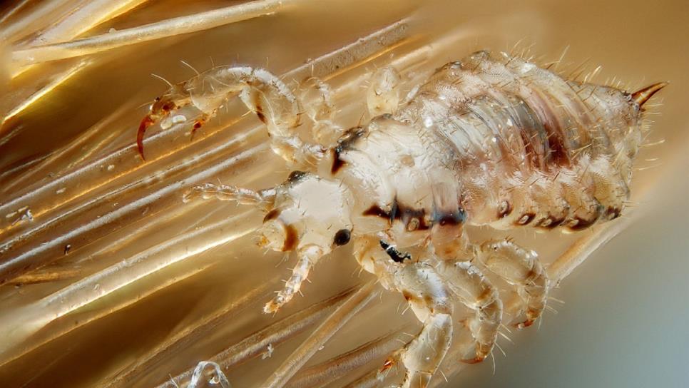 Aumentan casos de piojos por altas temperaturas