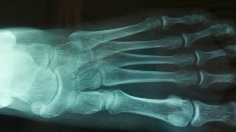 El proyecto se realiza en el Laboratorio de Materiales Avanzados y Cerámicos Funcionales del ITS.