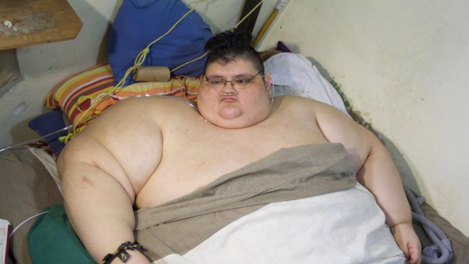 Mexicano más obeso del mundo inicia tratamiento integral