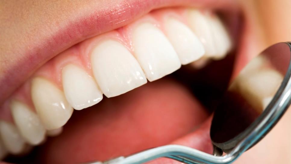 Crece número de adultos jóvenes que pierden piezas dentales