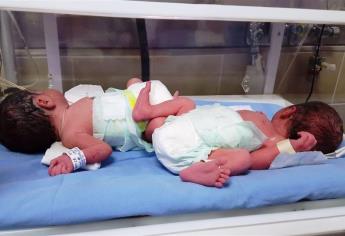 Histórico para IMSS, parto de gemelos de mujer de 58 años