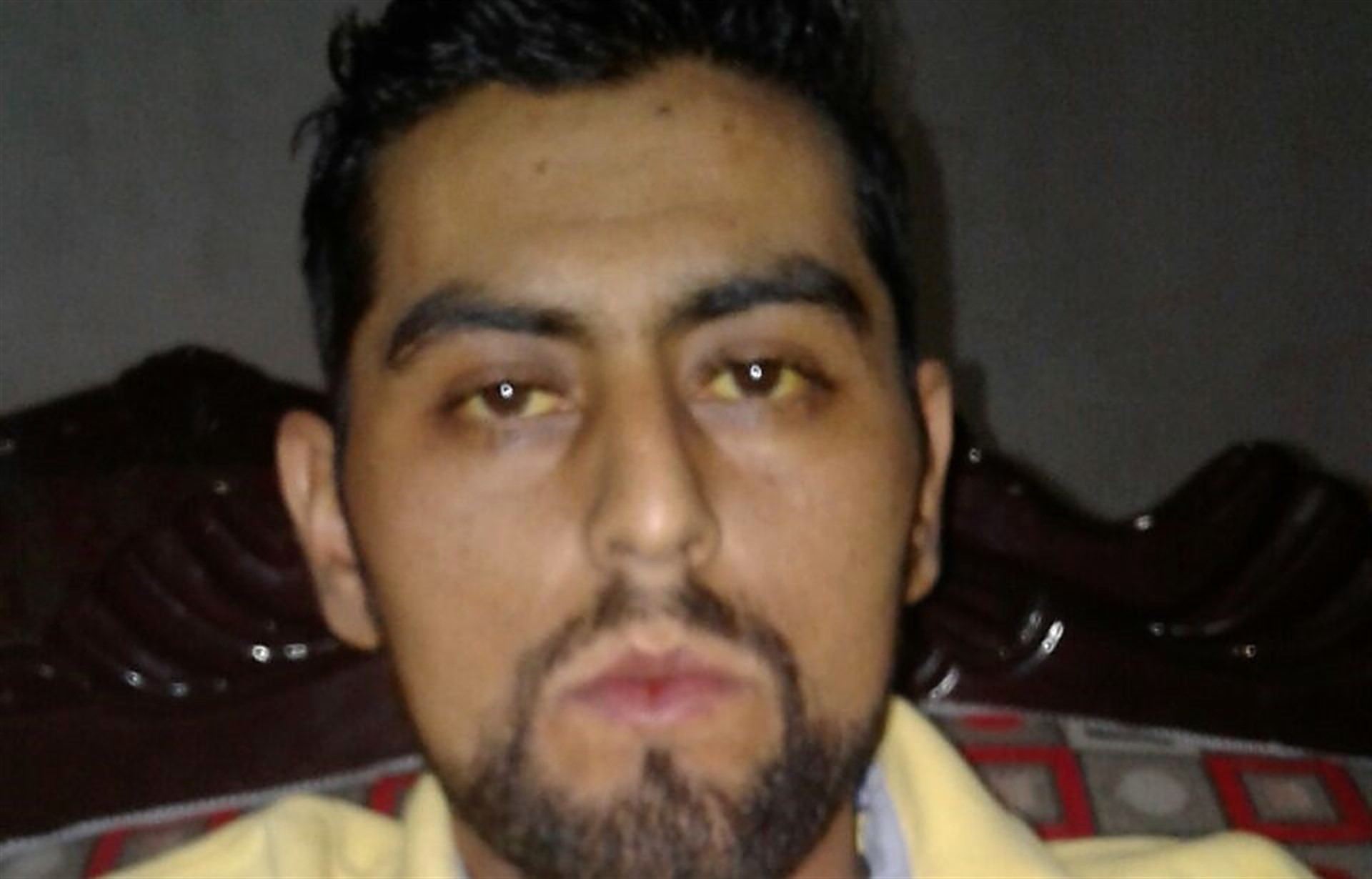 Rafael Salazar necesita un trasplante de hígado