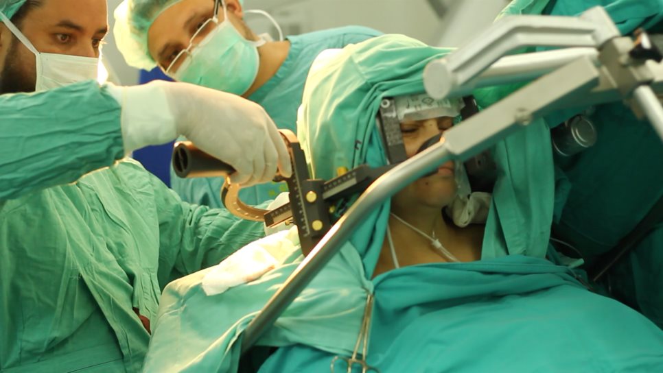 IMSS practica cirugías de tumor cerebral con paciente despierto