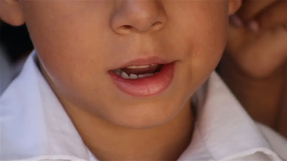 FOTOS: Martín Ruiz.