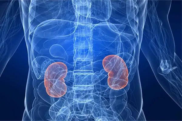 Pacientes con insuficiencia renal crónica van en aumento en el país Pacientes con insuficiencia renal crónica van en aumento en el país