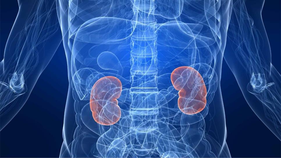 Pacientes con insuficiencia renal crónica van en aumento en el país