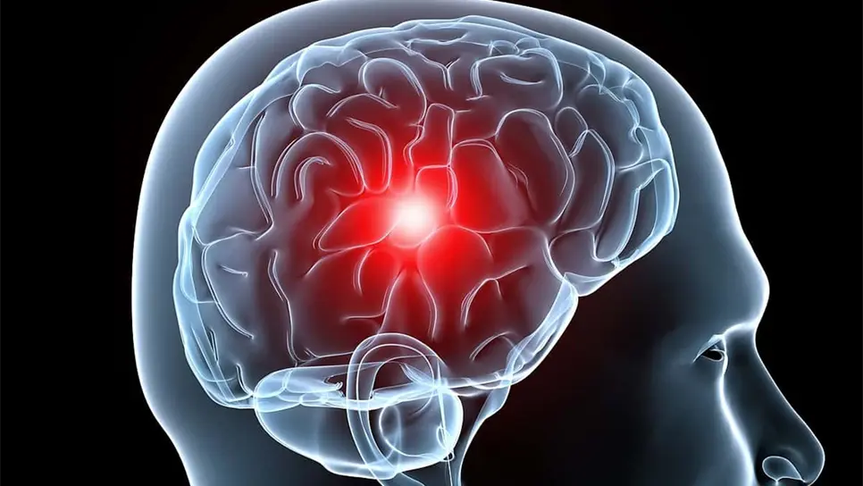 Consumo excesivo de alimentos en Navidad puede detonar migraña