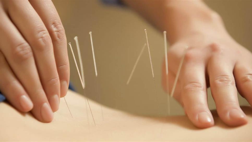 Pacientes con infertilidad buscan ayuda en la acupuntura