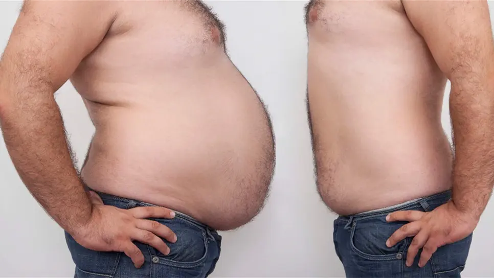 Experto pide bajar de peso de manera paulatina y sin dietas de pánico