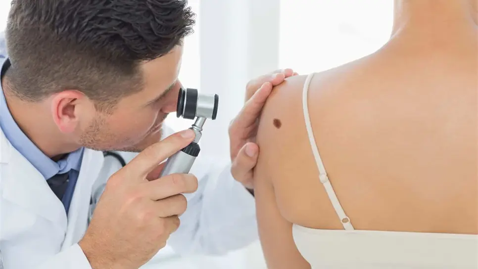 Recomienda IMSS revisar manchas y lunares en la piel