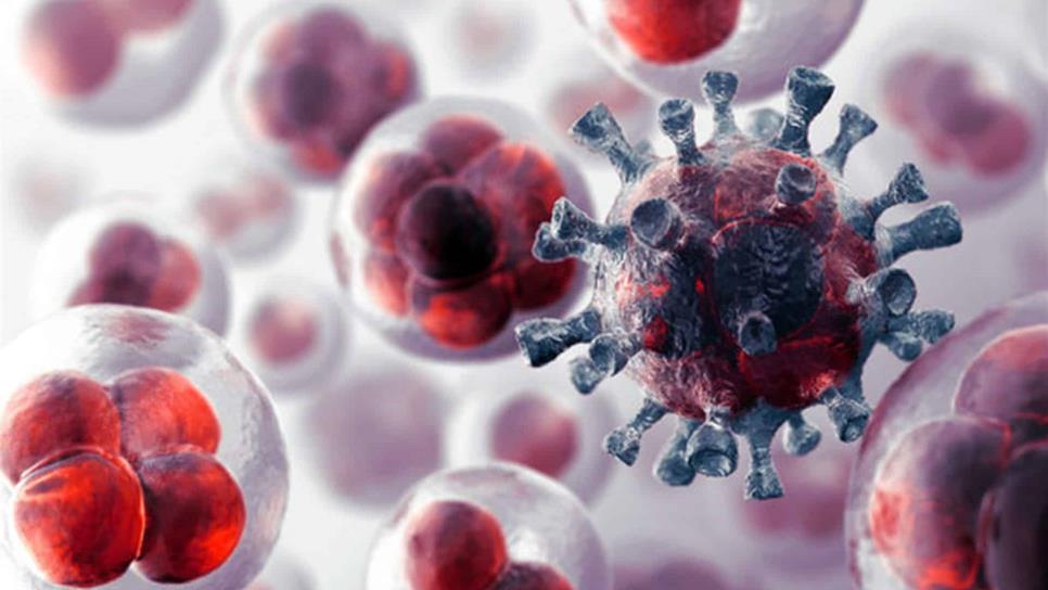 Sarcoma, tumor maligno difícil de detectar Sarcoma, tumor maligno difícil de detectar