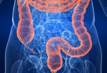 Consumir fibra disminuye riesgo de cáncer de colon ISSSTE