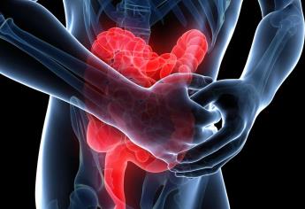 Tratan estreñimiento con innovadora cápsula vibratoria