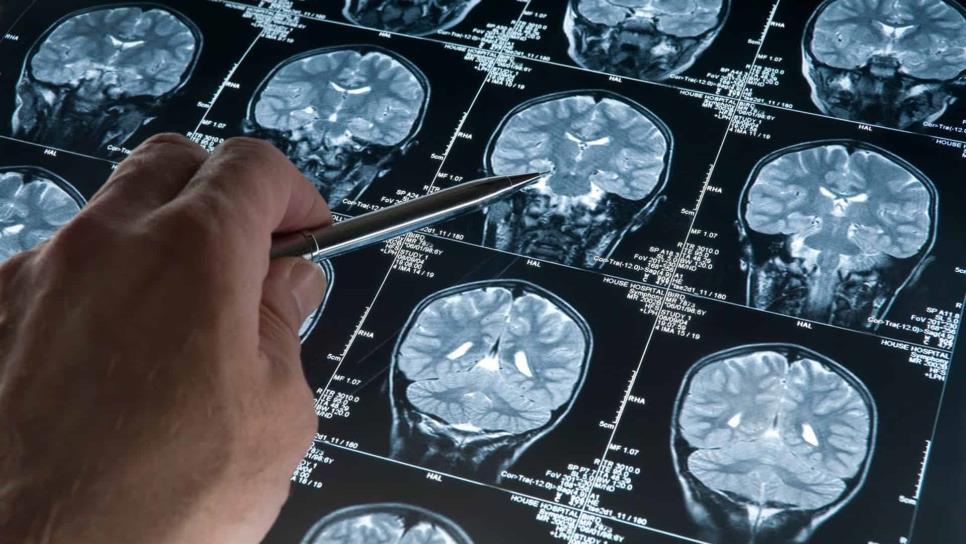 Indagan relación entre estilo de vida con salud cerebral en edad adulta