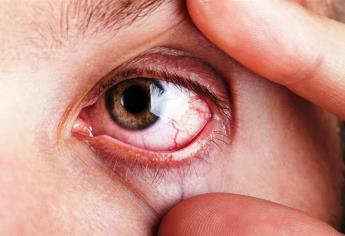 Oftalmóloga del Seguro Social sugiere cuidado de ojos ante calor