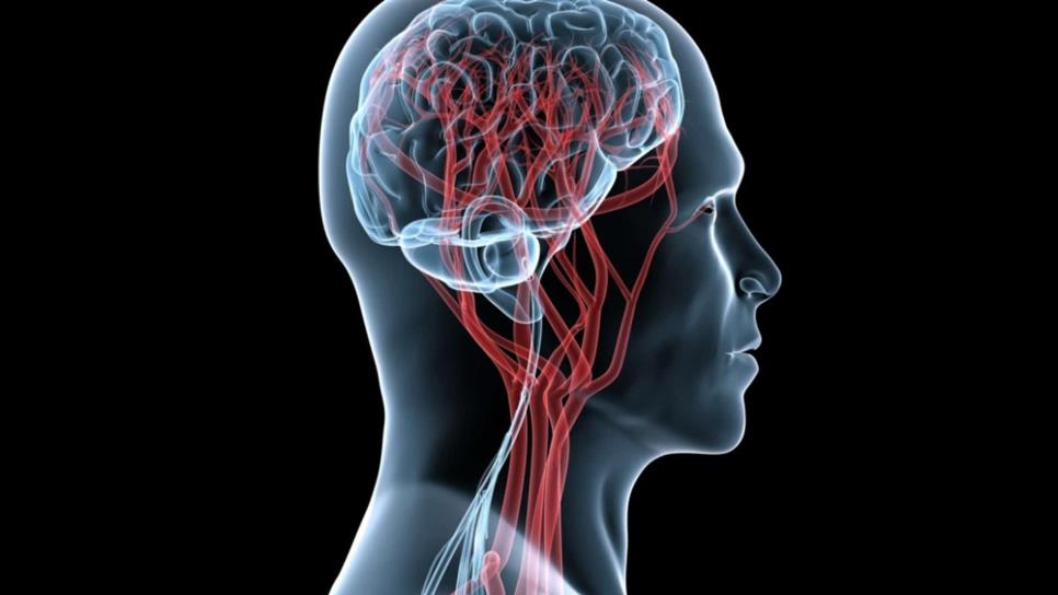 Derrame cerebral puede matar 633 mil neuronas por minuto