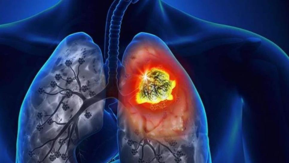 Presentan medicinas para tratamiento de pacientes con cáncer de pulmón