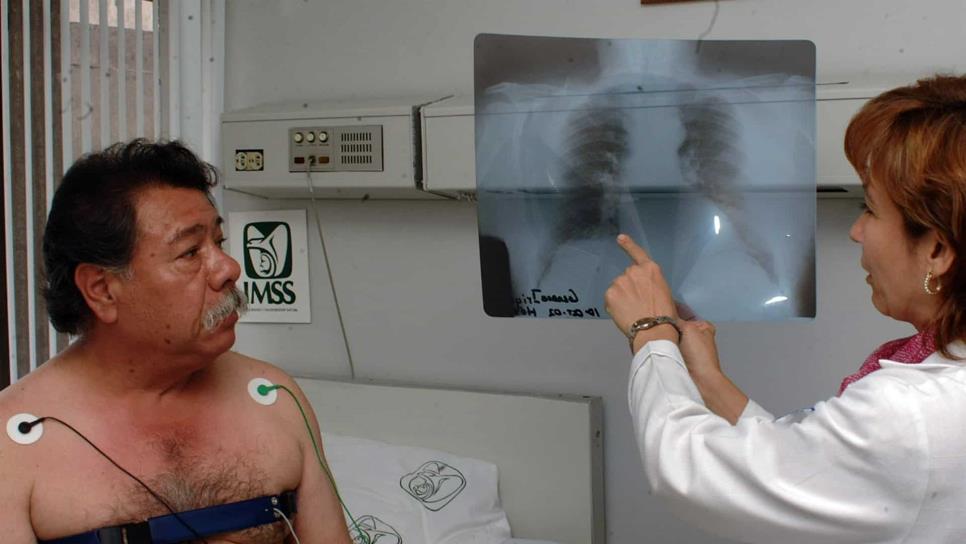Neumólogo advierte sobre gravedad de la fibrosis pulmonar idiopática