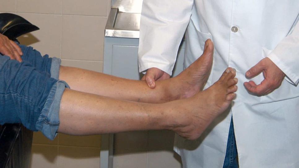 Higiene y cuidado de los pies, fundamental en diabéticos