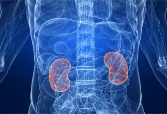 Hasta 40% de personas con lupus pueden desarrollar daño renal