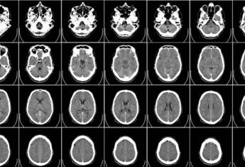 Neurocientíficos conectan 3 cerebros y logran compartir pensamientos