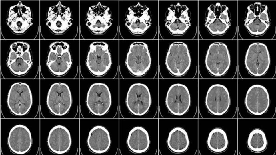 Neurocientíficos conectan 3 cerebros y logran compartir pensamientos