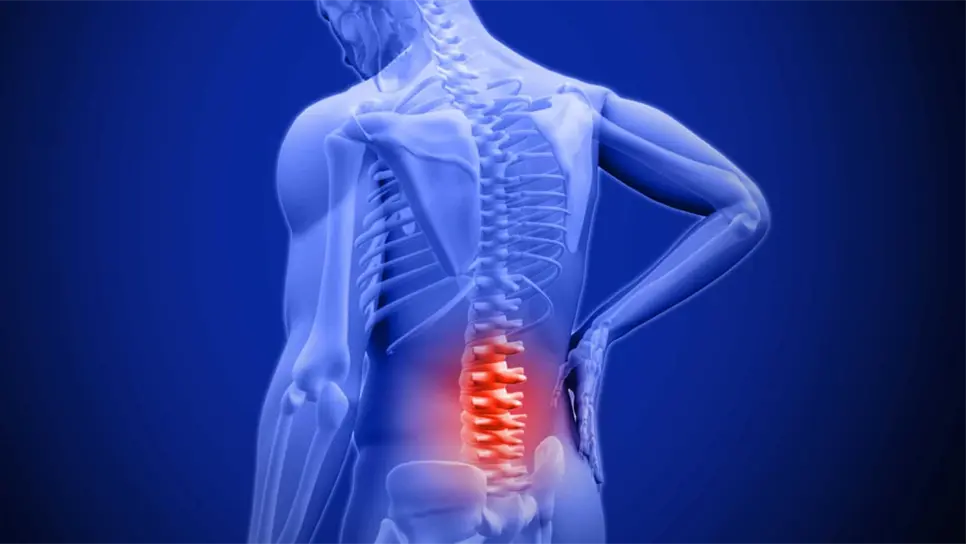 Lumbalgia, dolor de columna que afecta a jóvenes y adultos