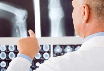 Uno de cada cinco hombres mayores de 50 años padece osteoporosis