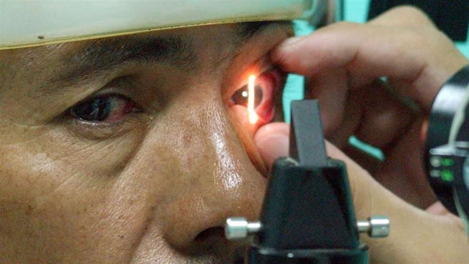 Cerca de 1.5 millones de mexicanos tienen glaucoma: UNAM