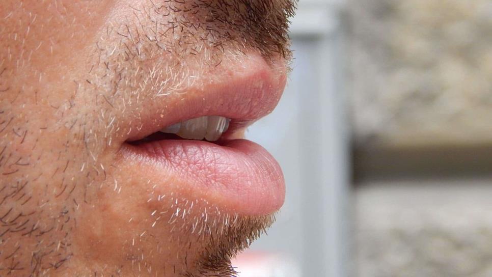 Xerostomía o resequedad de boca provoca desequilibrio en ambiente bucal