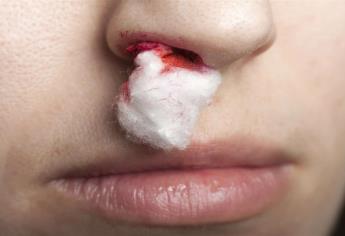 Hemofilia adquirida, enfermedad rara que también puede afectar a mujeres