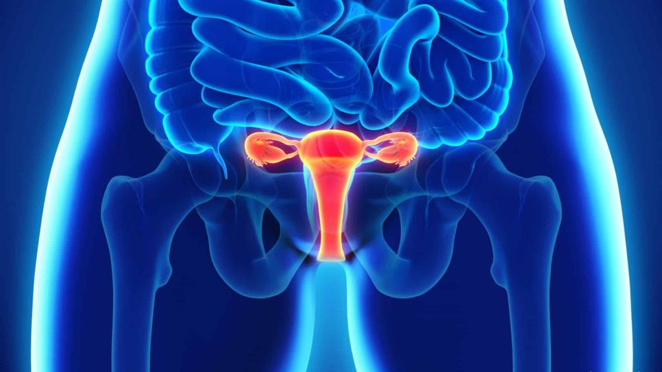 Cáncer de ovario, entre las enfermedades ginecológicas más letales
