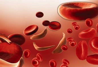 Cansancio excesivo en niños puede indicar anemia falciforme