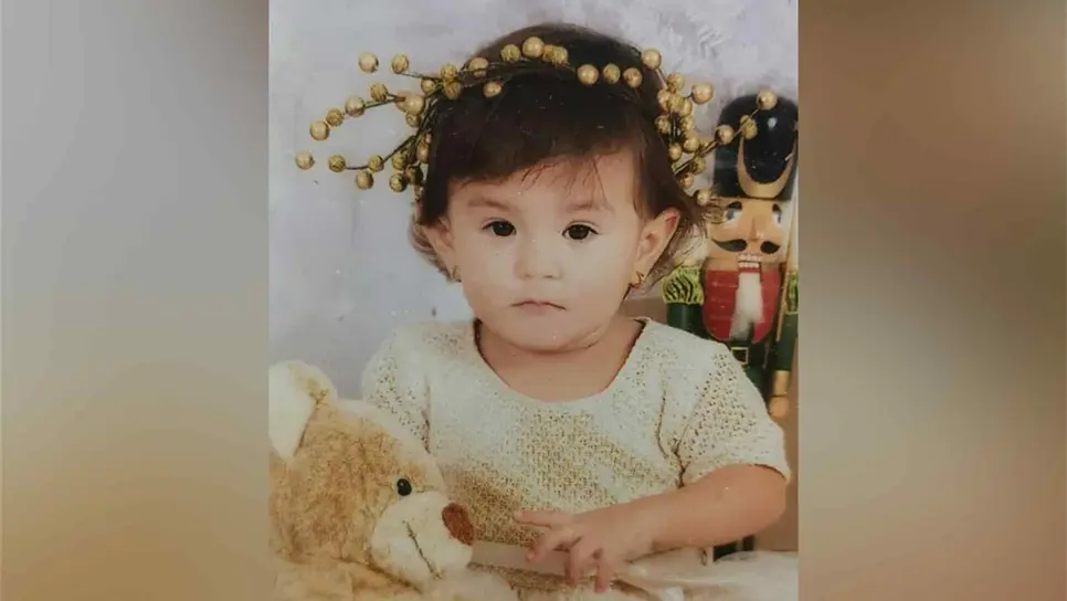 Alejandra tiene una malla de titanio, la cual le durará 5 meses y posteriormente será sometida a otra cirugía hasta que su cabeza deje de crecer. FOTO: Cortesía.