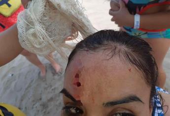 Turista regiomontana se lesiona durante paseo acuático en Mazatlán