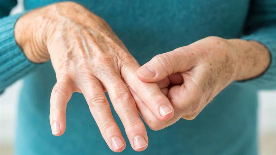 IMSS gasta al año mil 900 mdp por complicaciones de artritis reumatoide