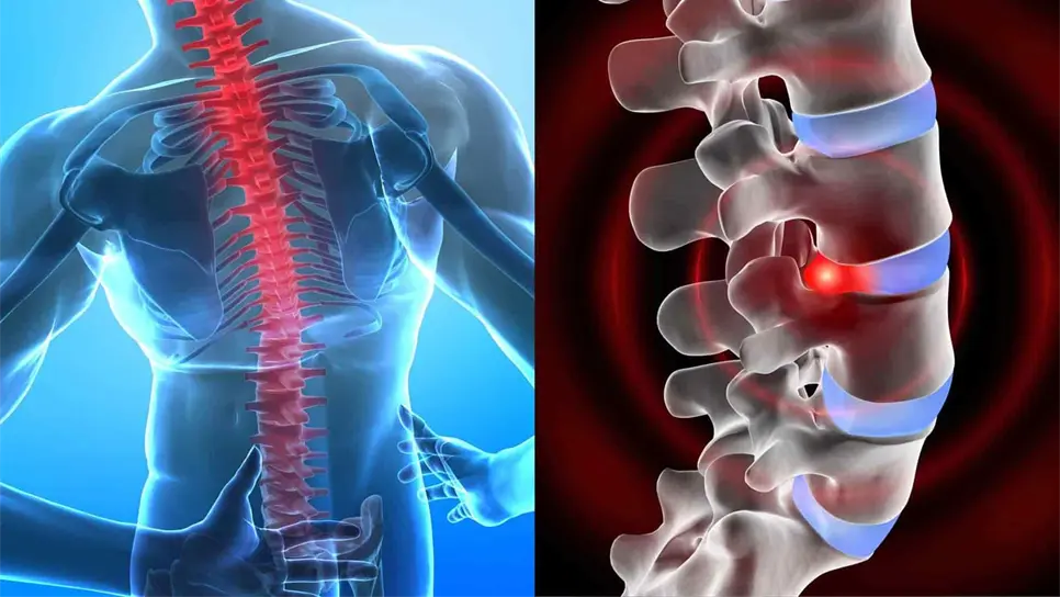 Recomiendan resonancia magnética ante sospecha de tumor en la columna