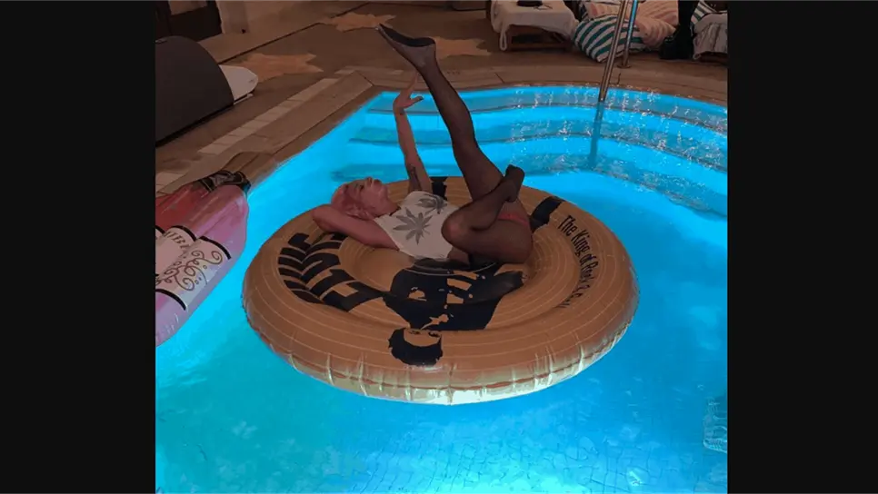 Lady Gaga se recupera de caída en una despedida de soltera