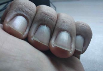 Los colores de las uñas reflejan padecimientos de salud: experta