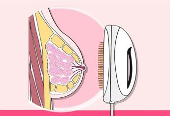 Proyecta IMSS tamizaje para cáncer mamario sin exposición a radiación