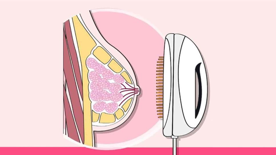 Proyecta IMSS tamizaje para cáncer mamario sin exposición a radiación Proyecta IMSS tamizaje para cáncer mamario sin exposición a radiación