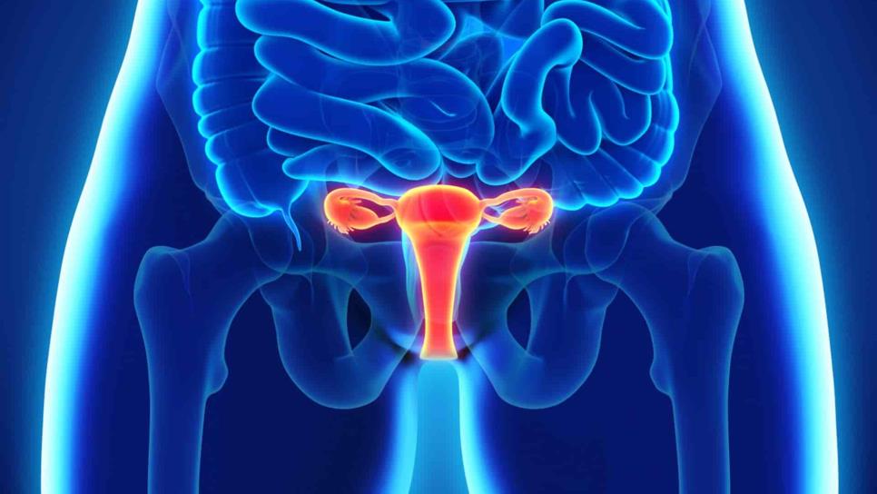 Síntomas digestivos pueden ser principios de cáncer de ovario