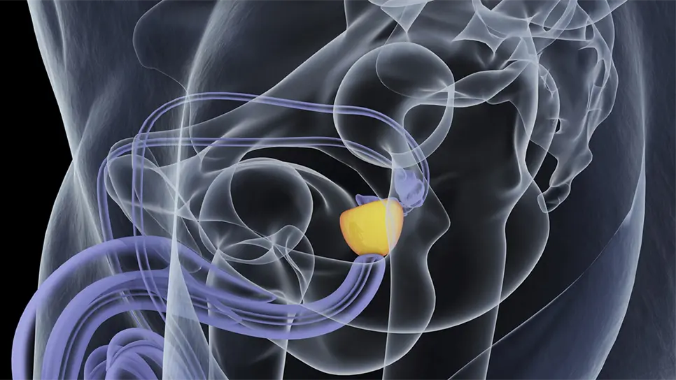 Para 2050 se triplicará el riesgo de cáncer de próstata: IMSS