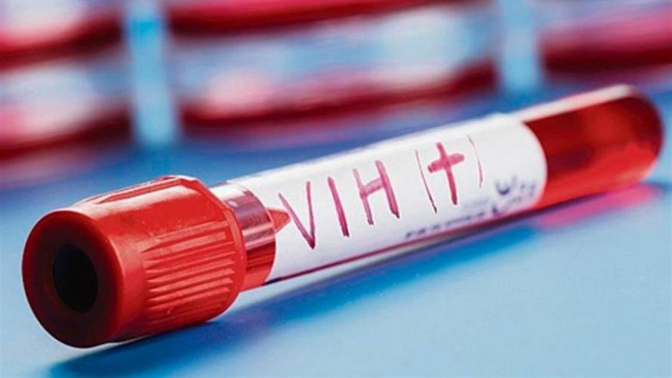 Más de 300 menores mueren diario en el mundo por VIH