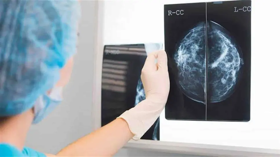 Mujeres menores a los 40 años no están exentas del Cáncer de Mama
