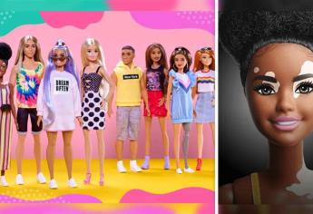 Barbie lanza muñecas inclusivas con vitiligo y prótesis