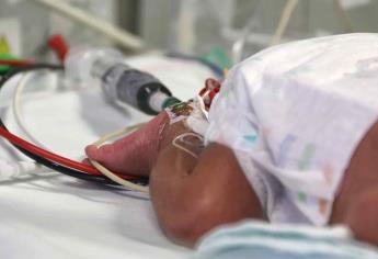 Cardiopatías congénitas, segunda causa de muerte en menores de un año