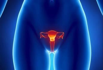 Mayoría de casos de cáncer de ovario, detectados en etapas avanzadas
