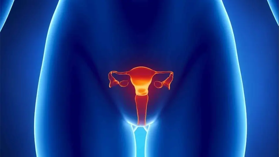 Mayoría de casos de cáncer de ovario, detectados en etapas avanzadas