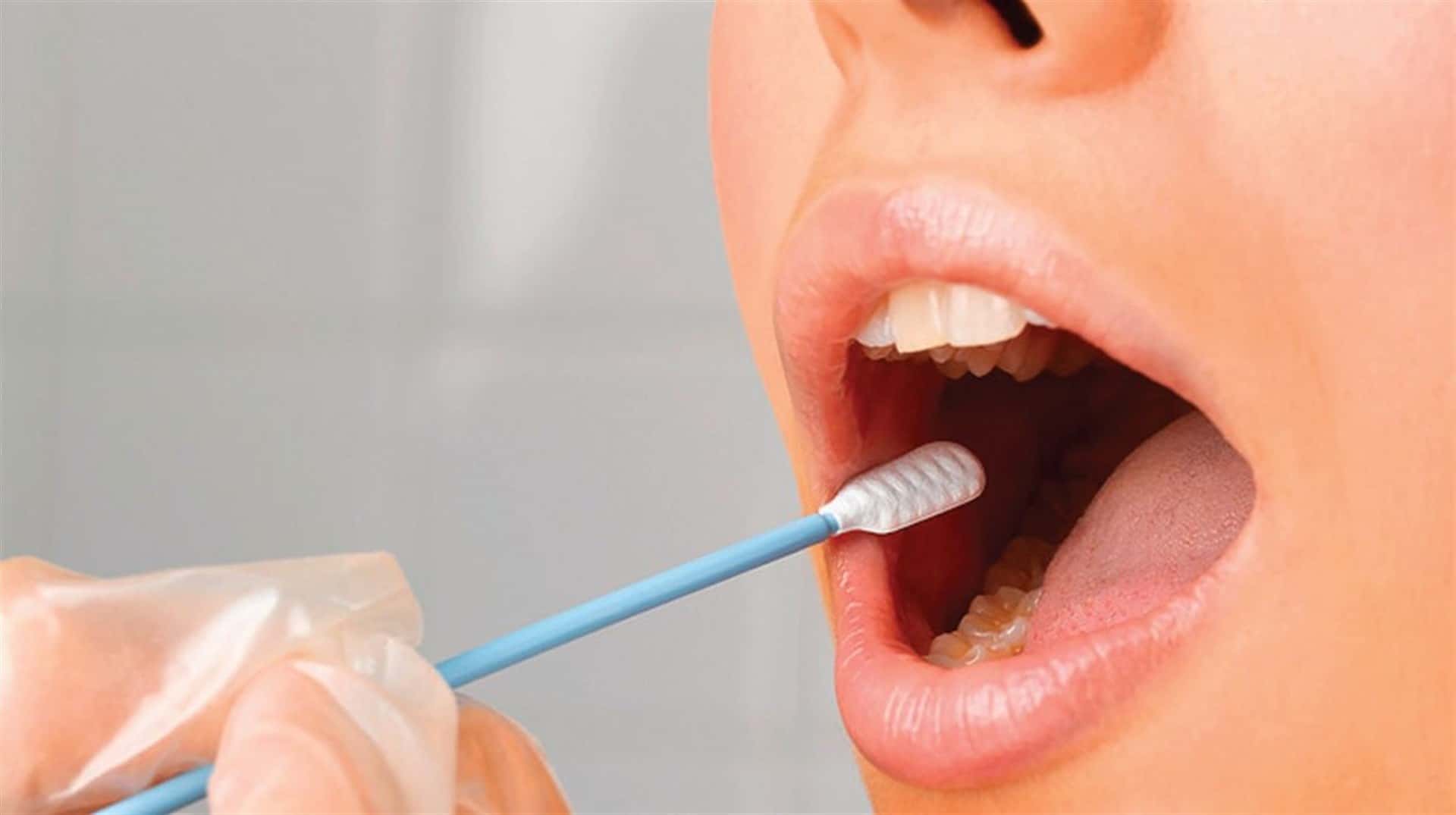 Conoce los tipos de tumores bucales